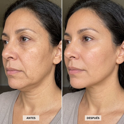 Rostro antes y después